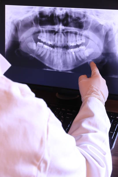 Best Emergency Wisdom Teeth Removal in Lecanto, FL