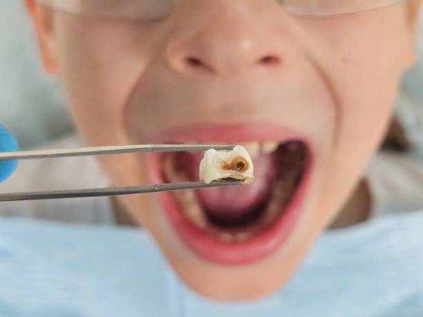 Best Emergency Dental Care for Trauma or Injury in Lecanto, FL