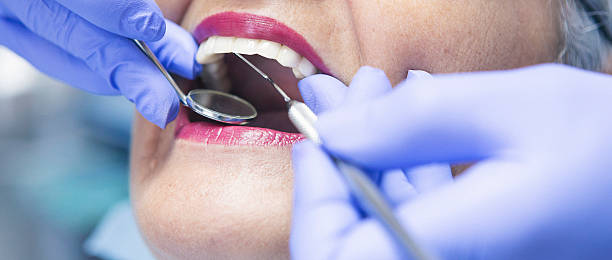 Best Walk-In Emergency Dentist in Lecanto, FL